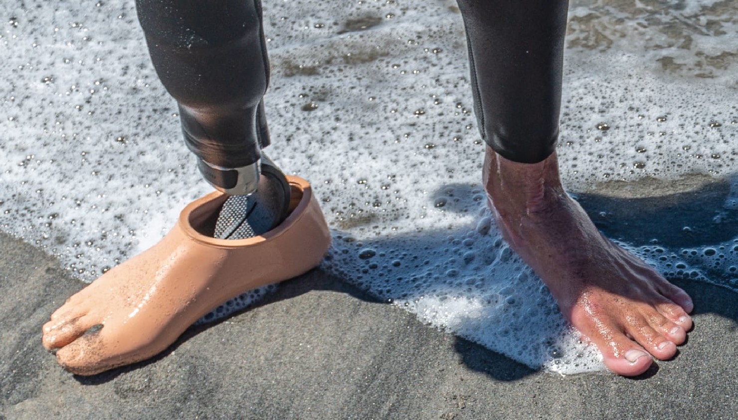 大腿假肢歩行指導方法的注意事項